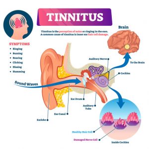 CBD for tinnitus